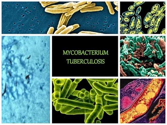 Mycobacterium tuberculosis(Microbiology)