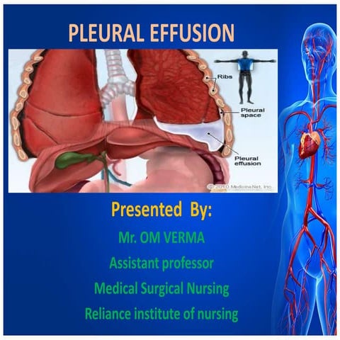 2. pleural effusion and chest drain tube vvi