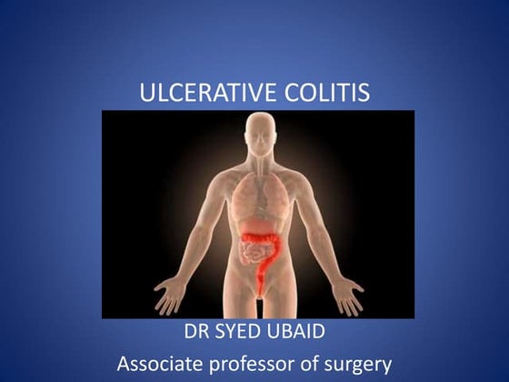 Ulcerative colitis