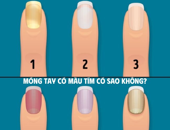 Móng tay có màu tím là bệnh gì? Có sao không? Cách chăm sóc móng