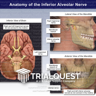 Medical Legal Exhibits - Legal Animations & Trial Graphics - Tria...