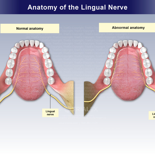 Anatomy of the Lingual Nerve