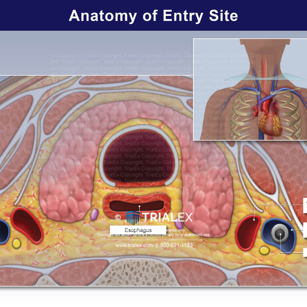 Anatomy of Entry Site