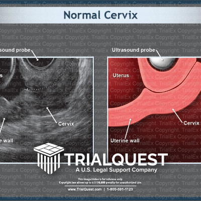 Normal Male Anatomy Of The Abdomen Trialexhibits Inc - vrogue.co