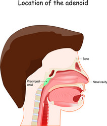 Nasal and throat nasopharynx diseases adenoids Vector Image