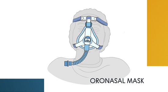 CPAP clinical use video thumbnail showing a oronasal mask