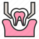 dental, dentist, dentistry, healthcare, tooth, tooth extraction