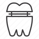 molar, crown, dental, implant