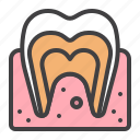 molar, tooth, dental, treatment