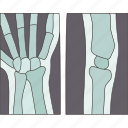 xray, joint, bones, orthopedic, anatomy