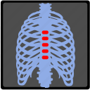 back, backbone, pain, ray, spine, vertebra, xray