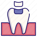 dental, dental fillings, dentistry, healthcare, medical, mouth, tooth