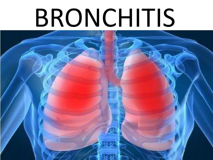 bronchitis