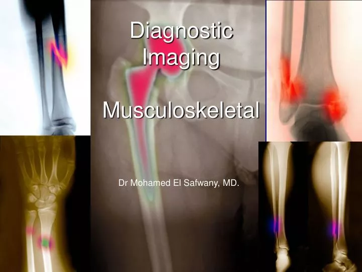 diagnostic imaging musculoskeletal