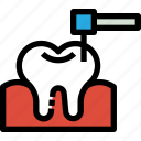 canal, dental, dentist, healthcare, medical, tooth