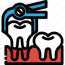 dental, dentist, extraction, medical, remove, tooth