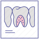 dental care, dentist, dentistry, stomatology, tooth x ray, x ray machine