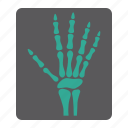 bone, hand, medicine, radiology, ray, x, xray