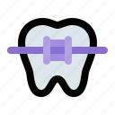 braces, bracket, dental, dentist, in, orthodontic, tooth