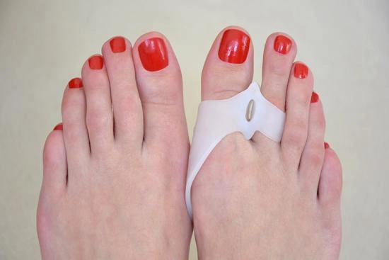 Les techniques d'un hallux valgus