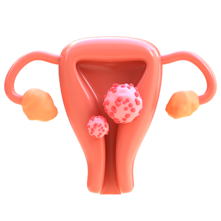 Cervical Cancer  3D Icon