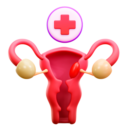 Cervical Cancer  3D Illustration