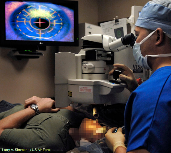 An eye surgeon carries out LASIK laser eye surgery