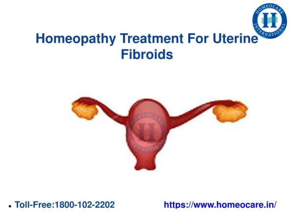 PPT - Uterine Fibroids PowerPoint Presentation, free download - ID:5612276