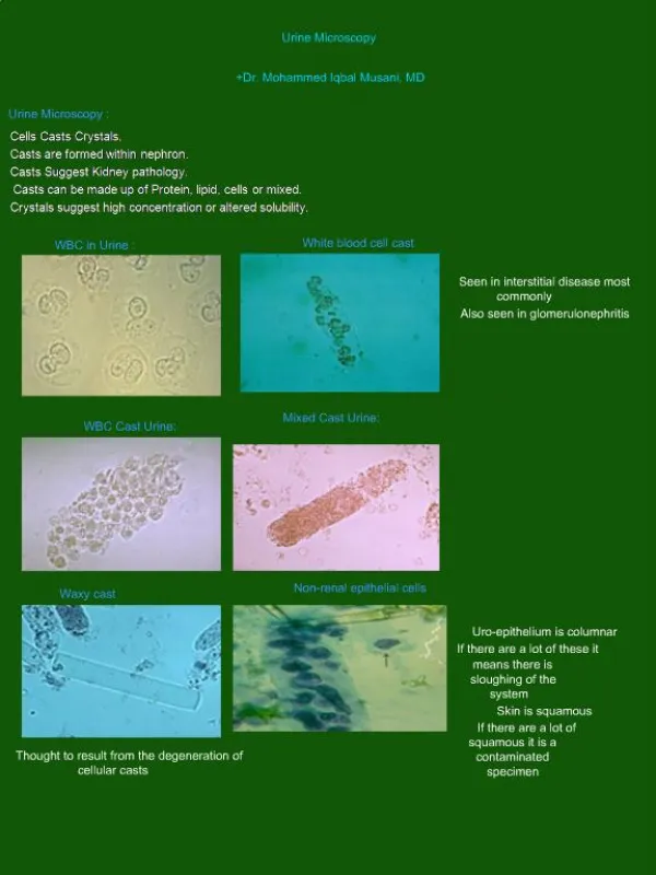 Urine Microscopy