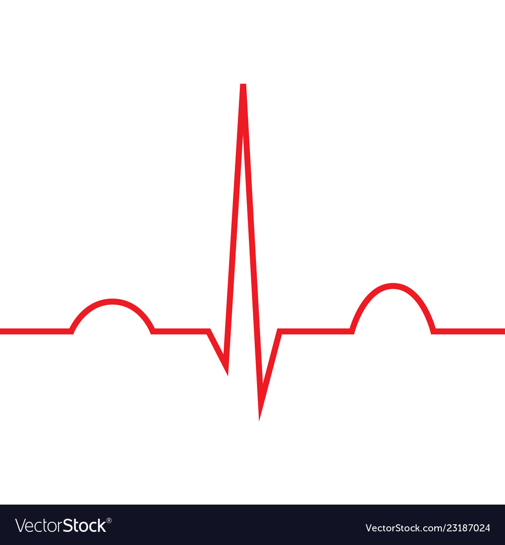 Collection 95+ Pictures Picture Of A Normal Ekg Sharp