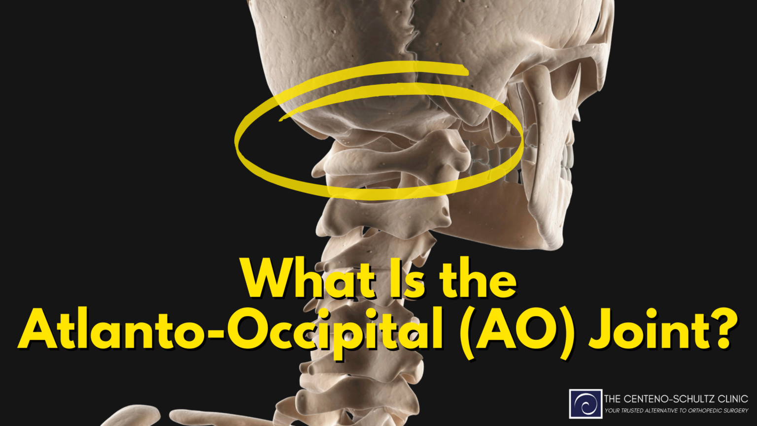 Articulacion Atlanto Occipital