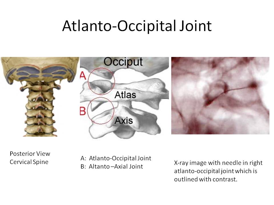 Atlanto Occipital Joint