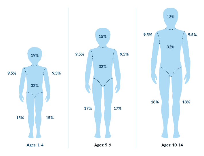 Graphic showing pediatric adaptation of rule of nines