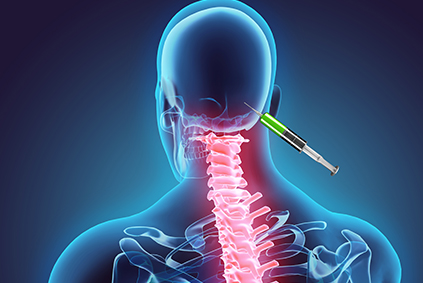 Occipital Neuralgia Cures