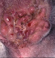 End stage ear disease