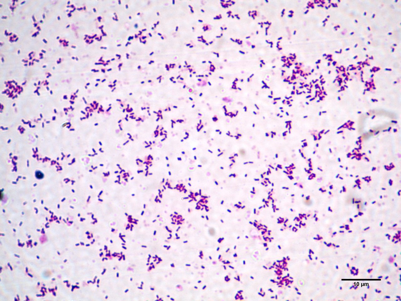 Listeria monocytogenes