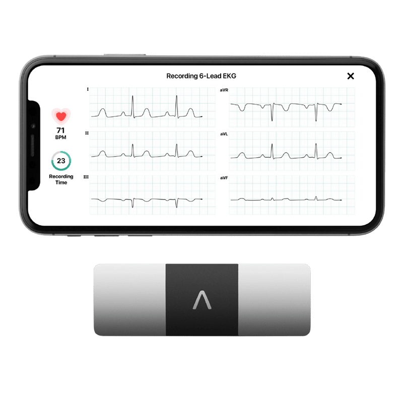 Alivecor KardiaMobile6L device