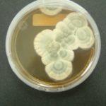 Penicillium Mold Health Effects and Removal Methods