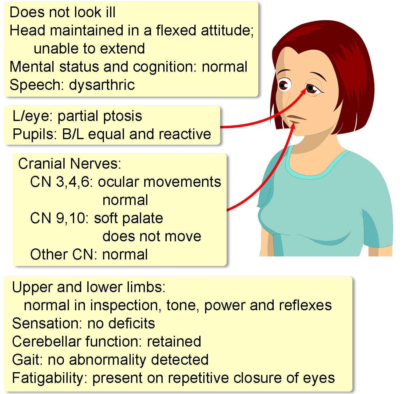 Myasthenia Gravis Causes