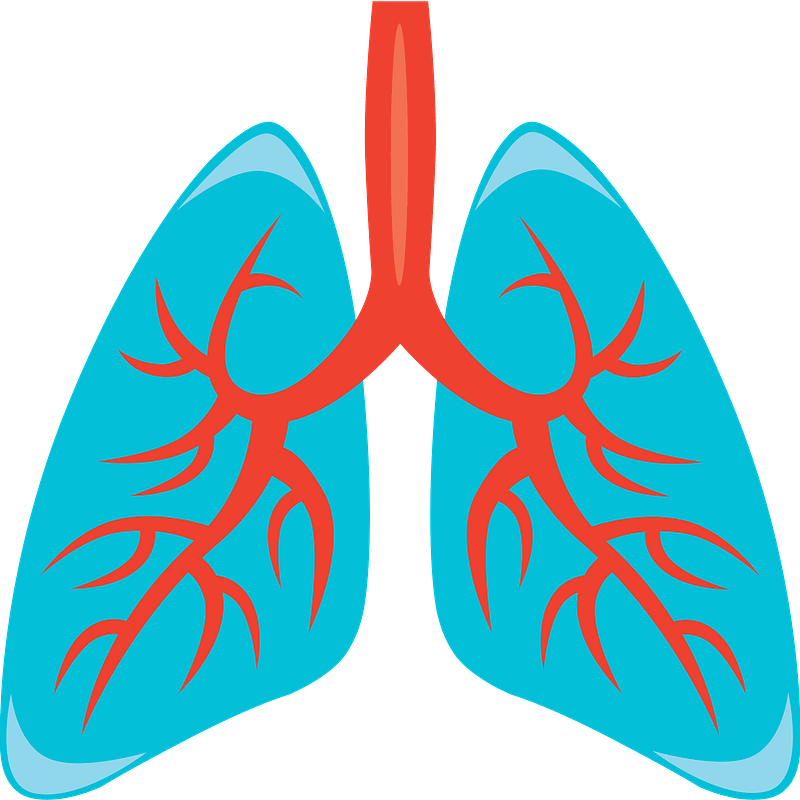 Lung Cancer Diagram In Detail Illustration Royalty Free SVG - Clip Art ...