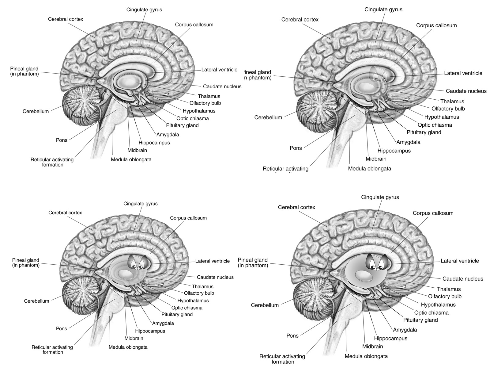 Labeled Brain Black And White