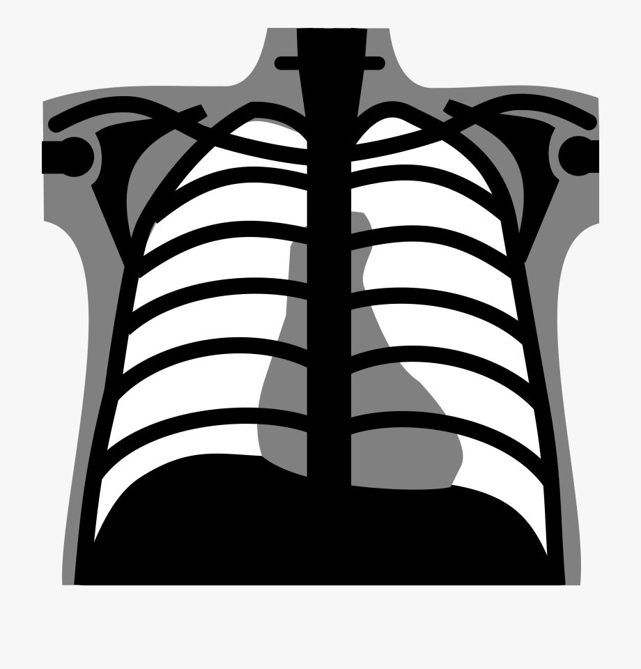 Png Royalty Free Library X Rays Clipart.