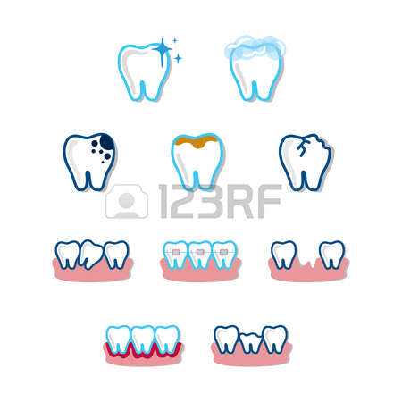 Caries Of Enamel Cliparts, Stock Vector And Royalty Free Caries Of.