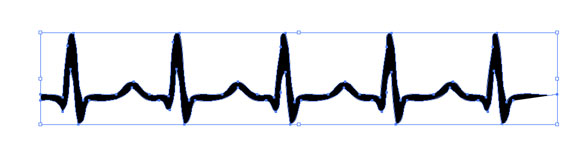 Normal Sinus Rhythm Clipart.