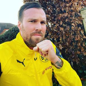 So sieht Kevin Großkreutz nach der Haartransplantation aus