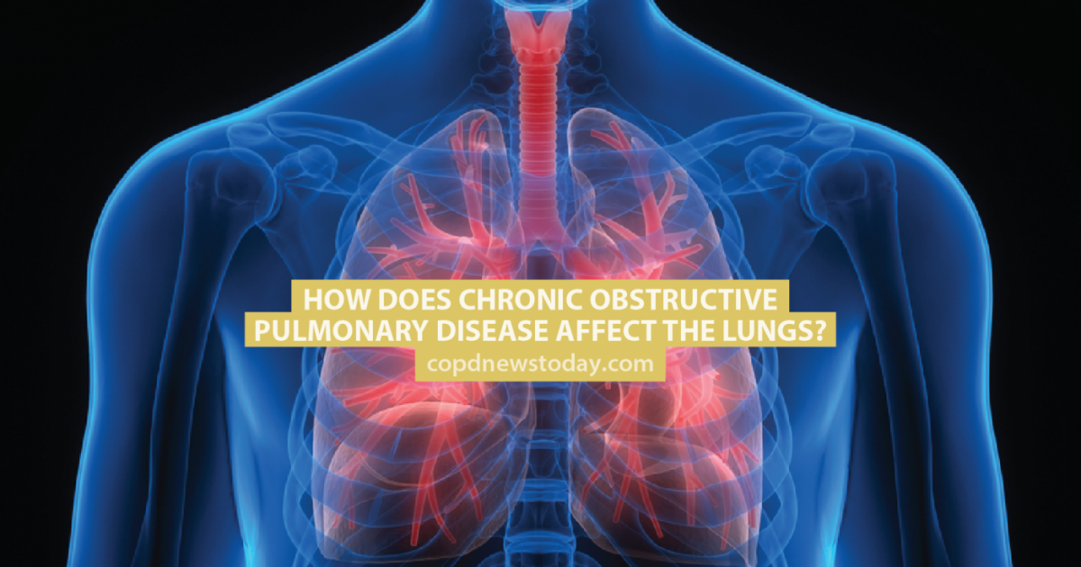 How Does Copd Affect Respiratory System - PELAJARAN