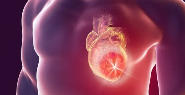 Understanding Distributive Shock Causes Symptoms and Emergency Response post img