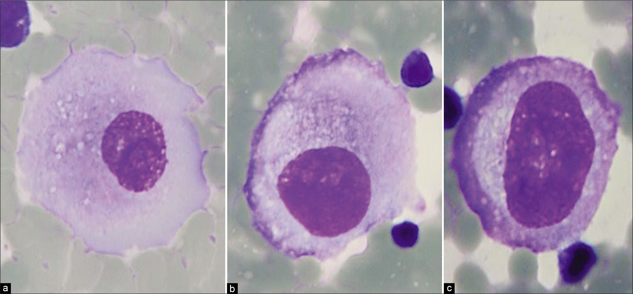 Human Macrophage Cell Line Astral Projection - vrogue.co