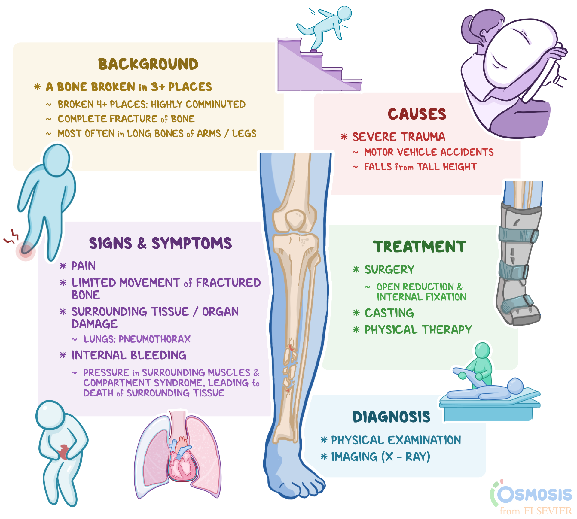 Understanding Comminuted Fractures: Causes, Symptoms, and Treatment - E ...