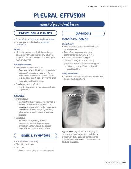 Pleural Effusions In 2021 Pleural Effusion Pathology Physiology Images